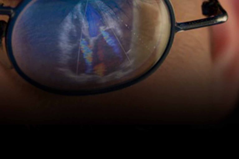 A person wearing round eyeglasses reflecting a medical echocardiogram heart ultrasound scan on the lens.