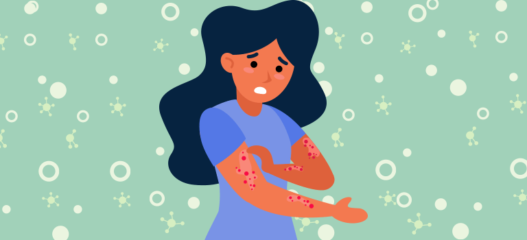 lady with skin rash/eczema