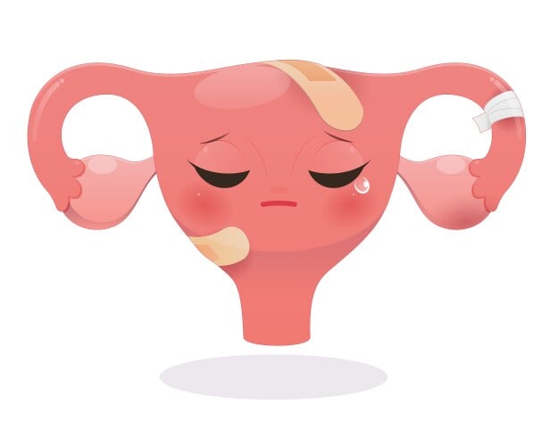 uterine disorders