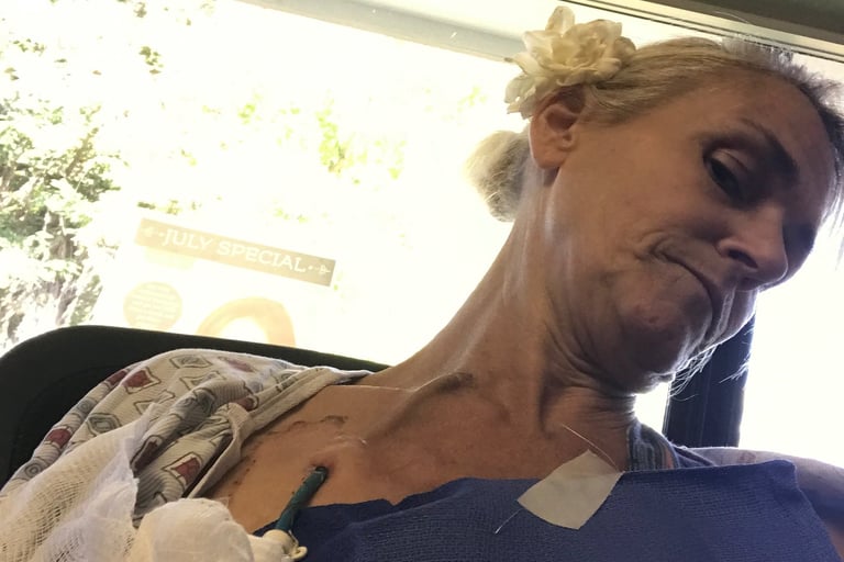 Celebrating Heart Port Removal