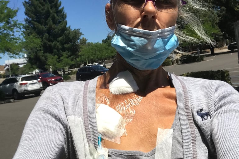 Prepping for my first dialysis