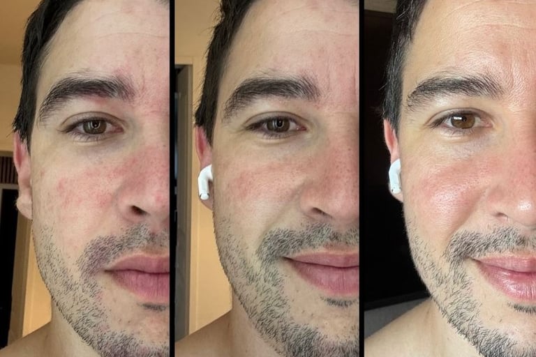 Le témoignage en images de Guillaume Aptouche sur HL Skin, gamme de soins pour le visage Herbalife, 