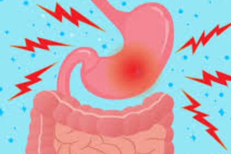 Emesis and Upper Digestive Tract Blockages
