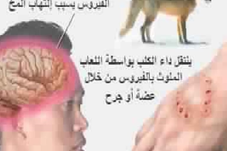يسبب التهاب المخ