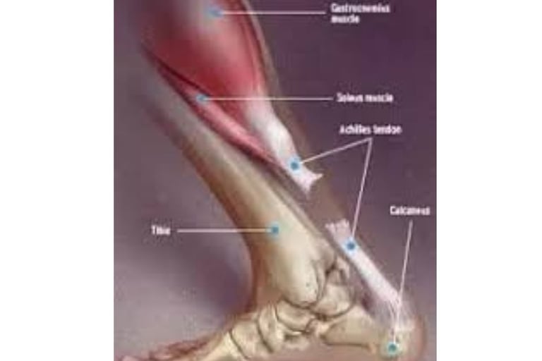 Achilles Tendon Injury Broad Overviews