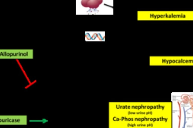 Tumor Lysis Syndrome (TLS) & Fasting