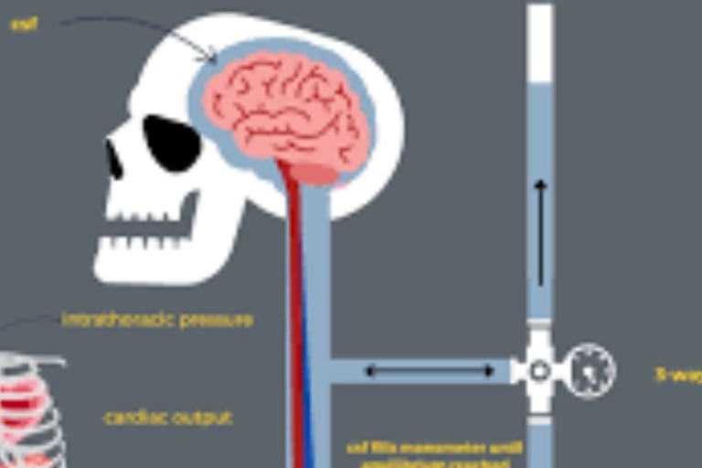 ๐ง ๐ Idiopathic Intracranial Hypertension (IIH) and Voluntary Fasting ๐
