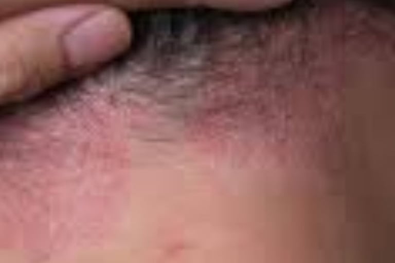 🧬 How Fasting Calms the Immune System in Psoriasis and Eczema