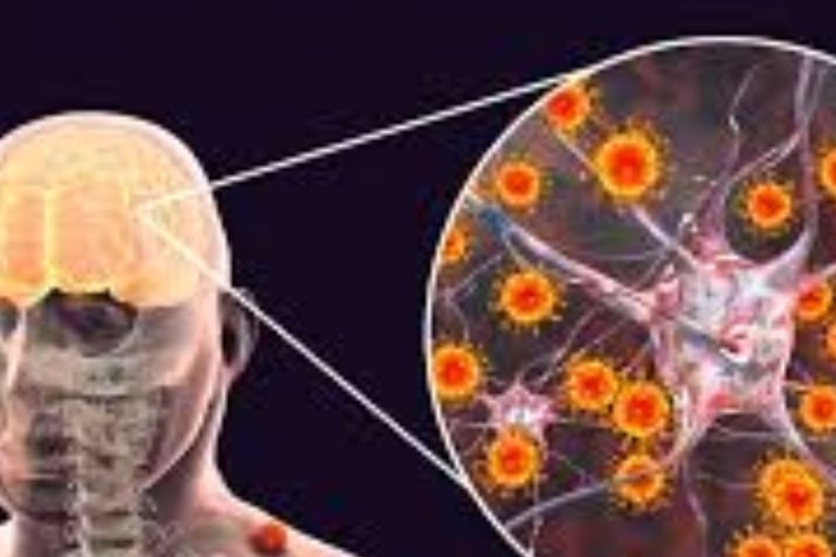 Eastern Equine Encephalitis (EEE)