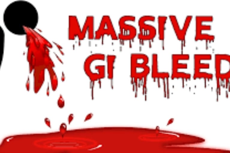 Esophageal Varices A gi bleed