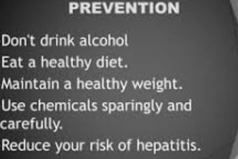 Esophageal Varices Managements prevention