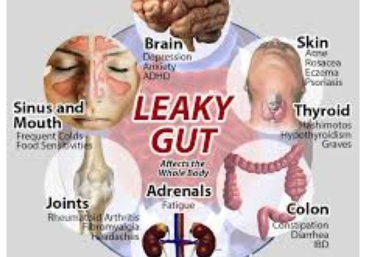 Leaky Gut Syndrome New View to Symptoms, Diagnosis & Treatments 1