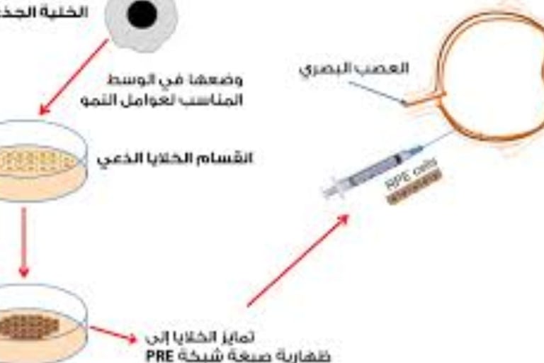علاج العمى