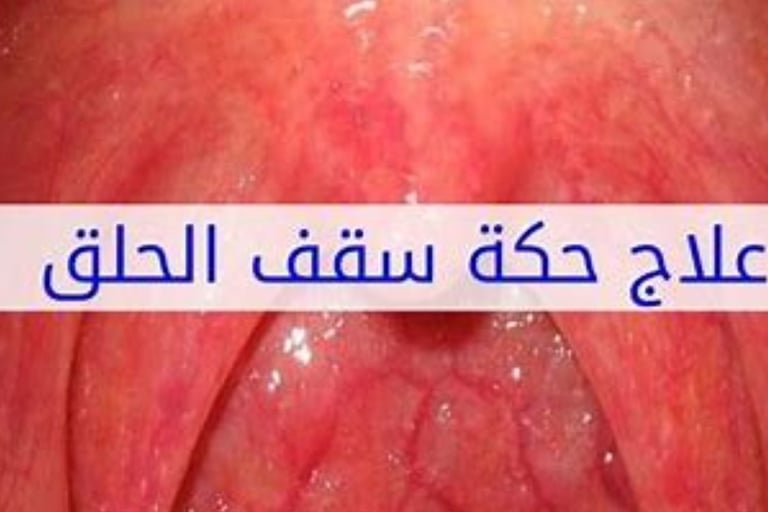 حكة بالحلق