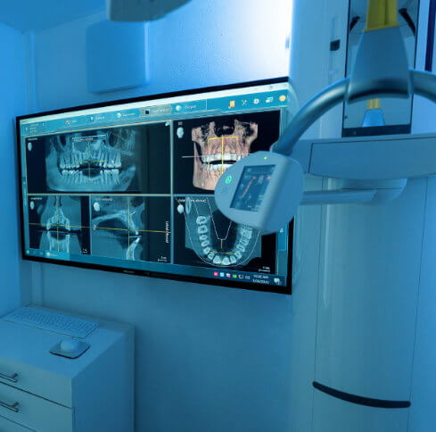 cone beam ct scan dental implants mexico advanced imaging