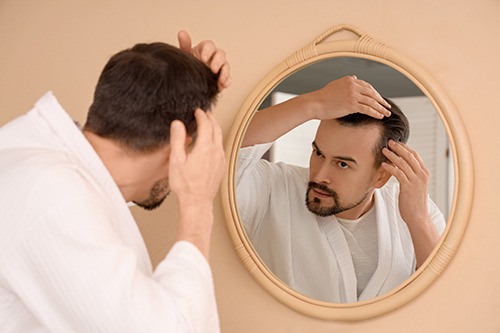 man-checking-hair-loss-thinning-hair-mirror-scalp-concern