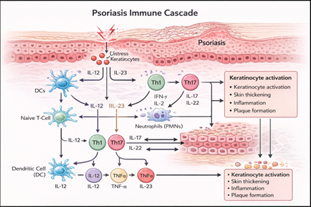 Psoriasis Immune Cascade