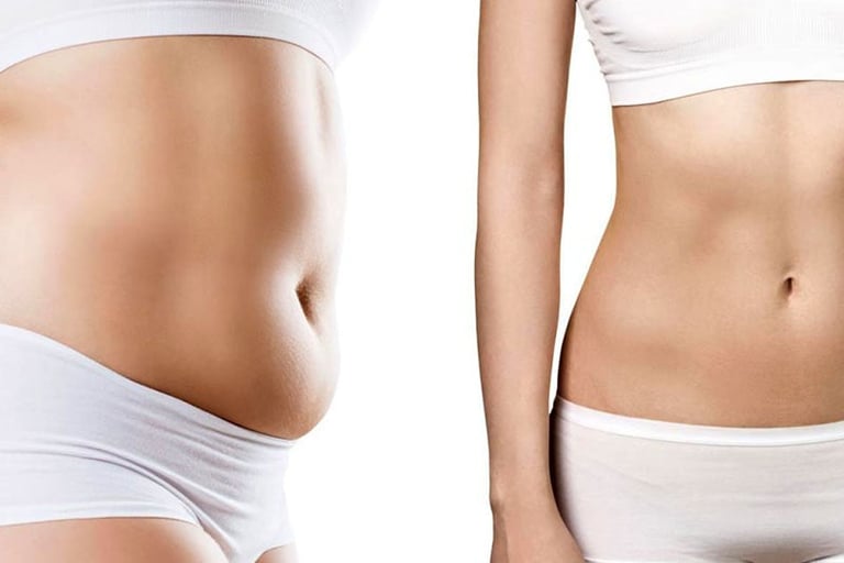 eliminare il grasso addominale