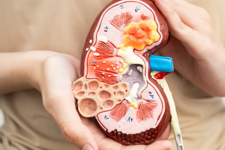 A person holding an anatomical human kidney model showing internal structures and disease pathologies.