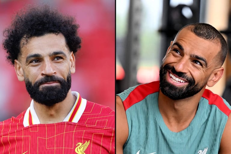 زراعة الشعر محمد صلاح