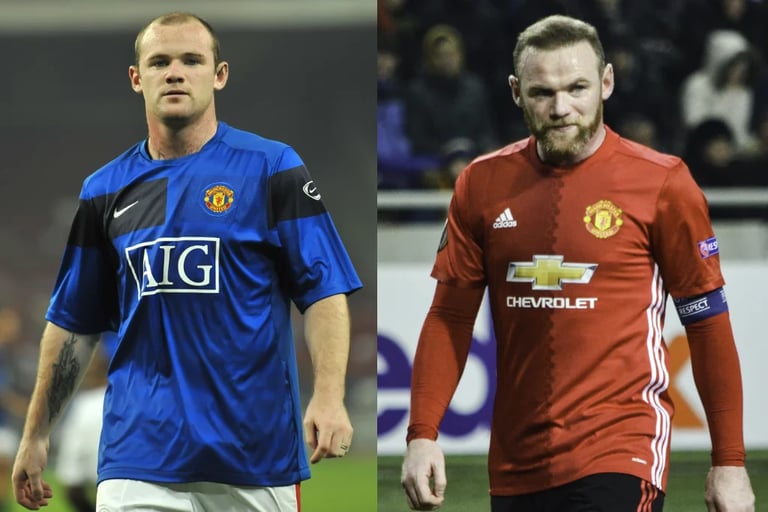celebrities hair transplant wayne rooney