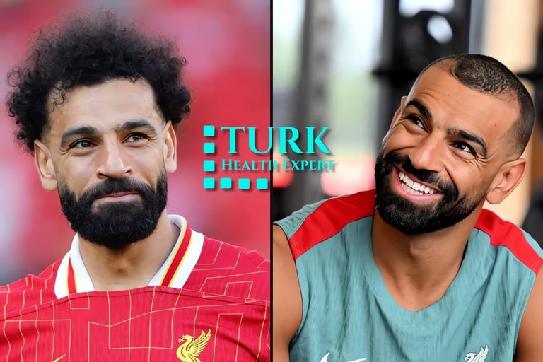 mohamed salah hair transplant clinic