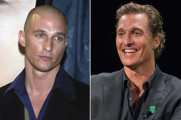 Matthew McConaughey hair transplant