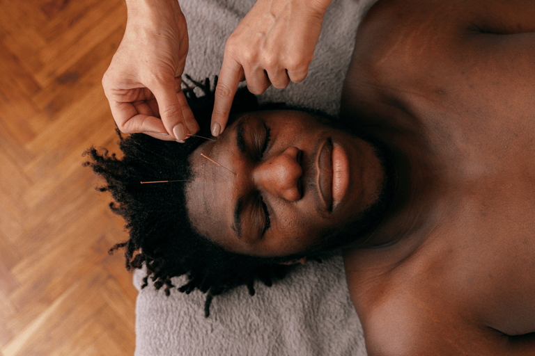 a man with black hair and darker skin is relaxing while receiving acupuncture 