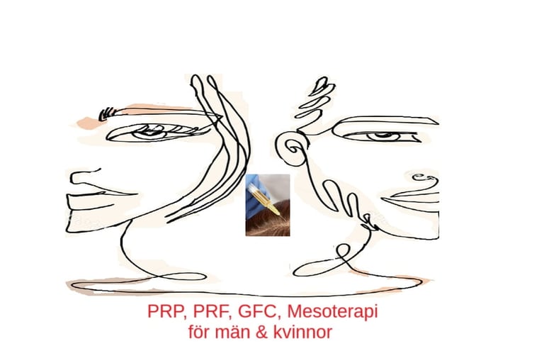 Mesoterapi, PRP, PRF och GFC för hudföryngring och hårbehandling illustrerat på man och kvinna