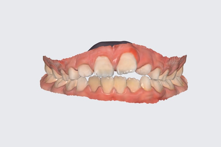 escaner dental para niños