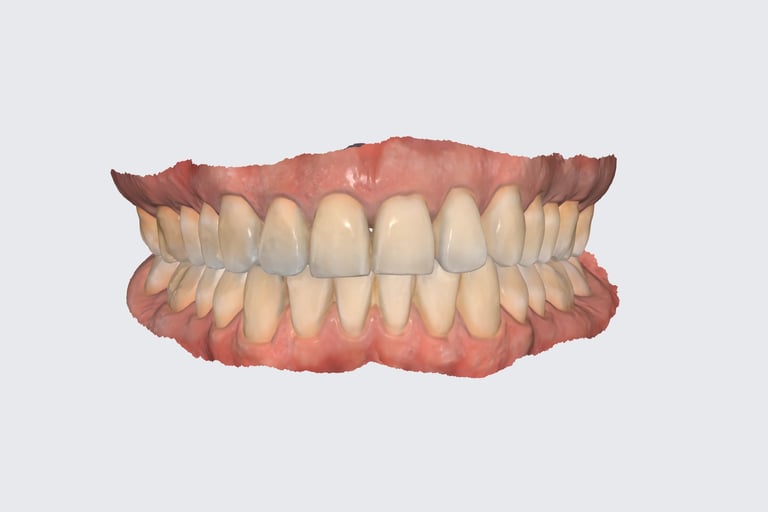 scan dental para adultos