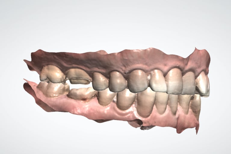 scaner dental para coronas