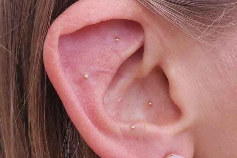 acupuncture phoenix, electro-acupuncture, EAN therapy, auriculotherapy, gold ear seeds, holistic