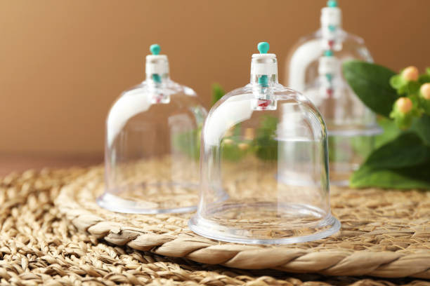 Cupping in Temecula California