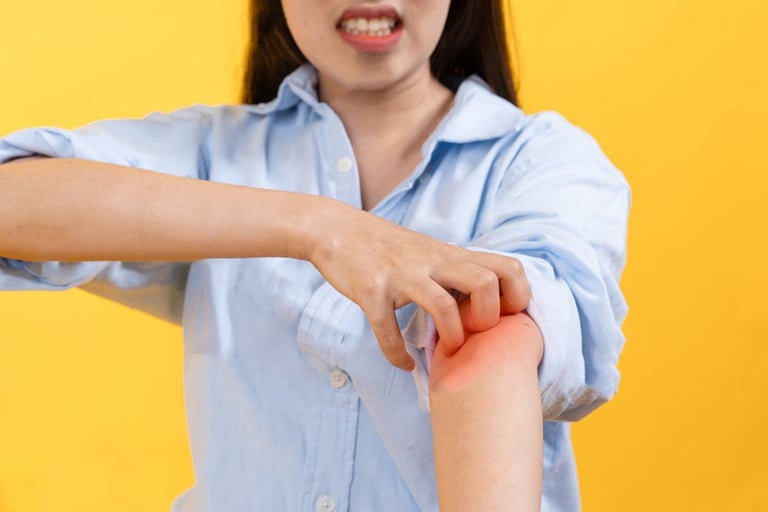 Rash, Itchy, Allergic Reaction, Cream, Medication, Skin, Itching, Hives, Bite