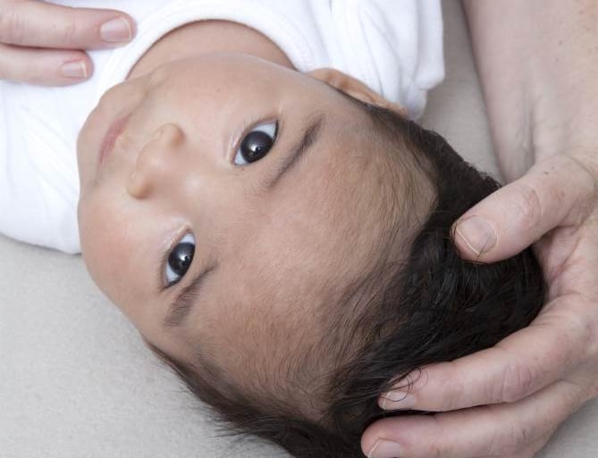 baby craniosacral therapy