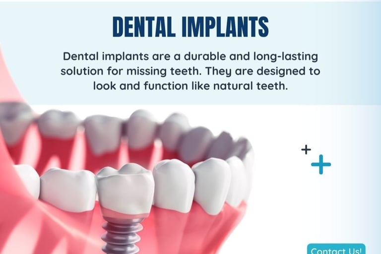 Boring digital marketing for dental implants