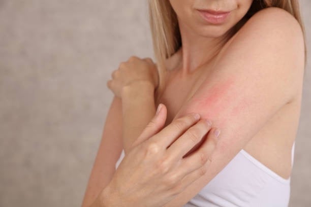 sensitive skin