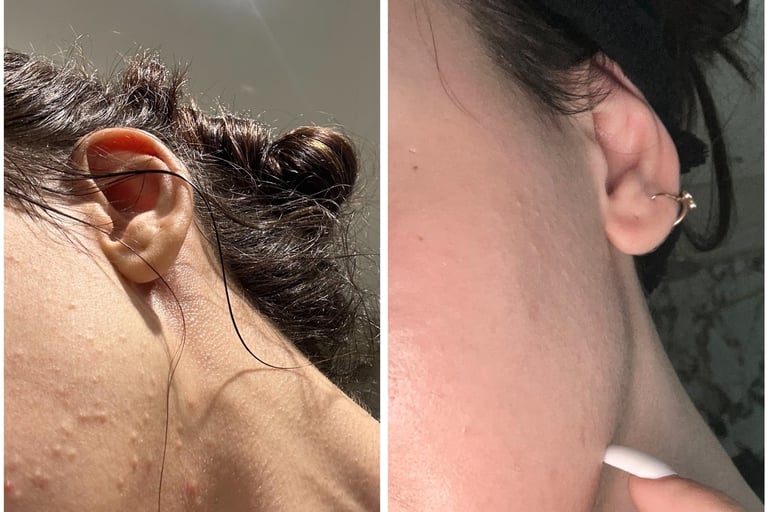 testimonial skin before and after