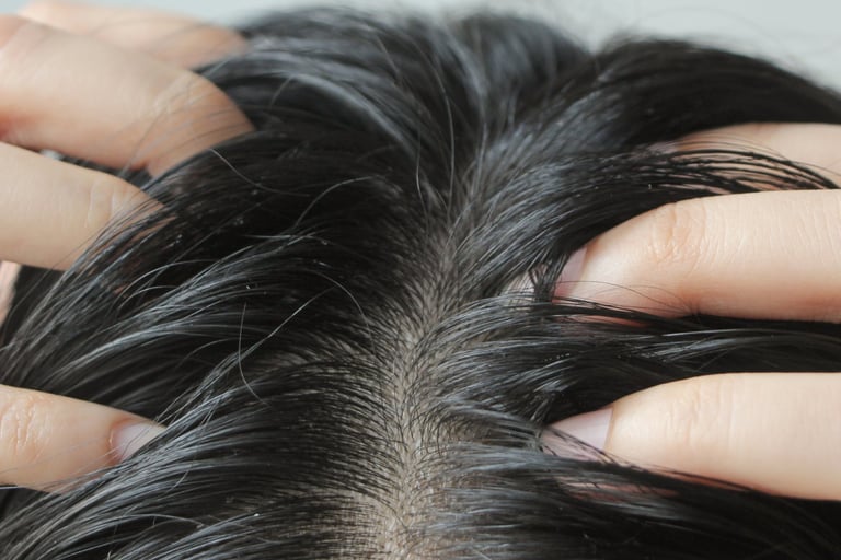 hair scalp image