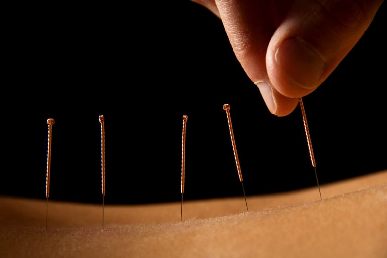 acupuncteur bernin au perchoir