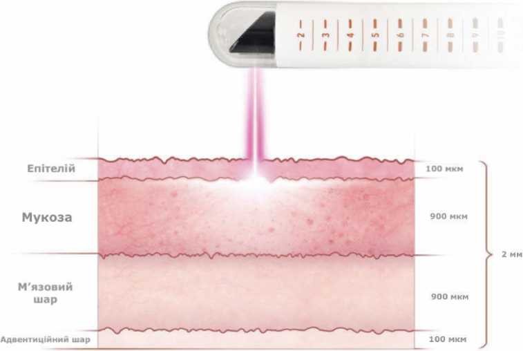 фото Схема як працюе juliet