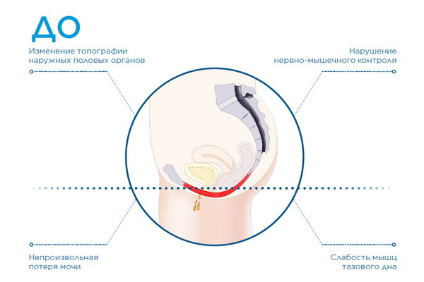 фото До процедури 