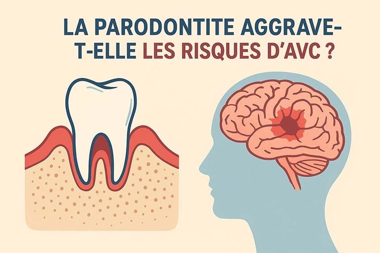La parodontite et les risques d’AVC hygiene-precision.com