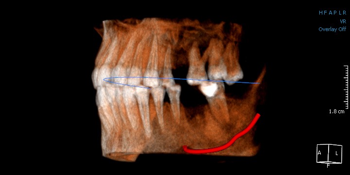 picture of a CBCT xray