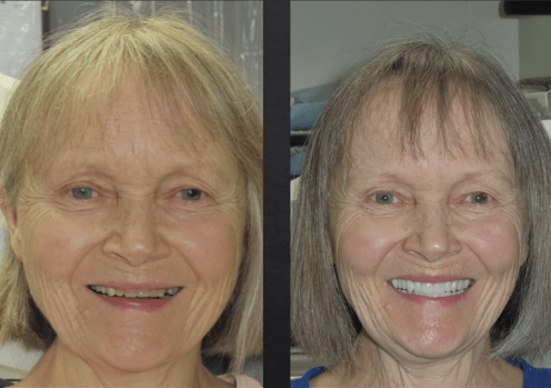 video of women's dental transformation