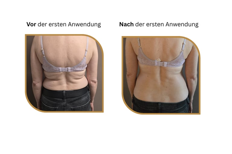 Reabalance Methode Vor und nach der Anwendung