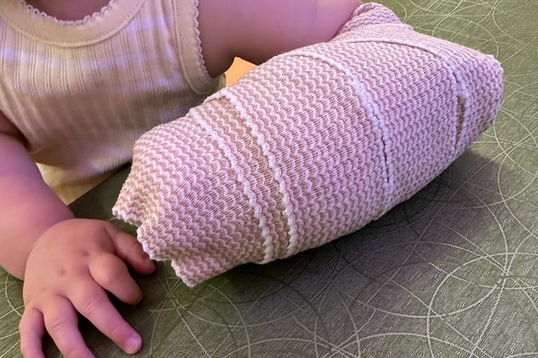 Toddler in splint for broken wrist
