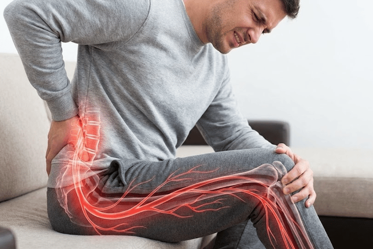 Person in pain with sciatica symptoms