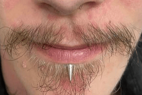 Safe lip piercing performed with hypoallergenic jewellery